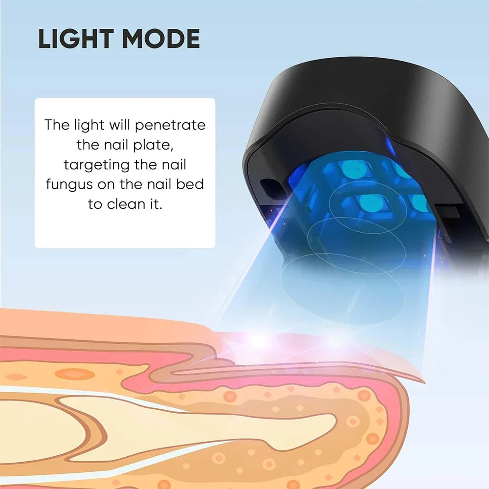 Appareil laser LED pour le traitement des mycoses des ongles, pour le nettoyage de l'onychomycose, charge USB, lumière infrarouge 905 nm, lumière bleue 470 nm, salon de manucure