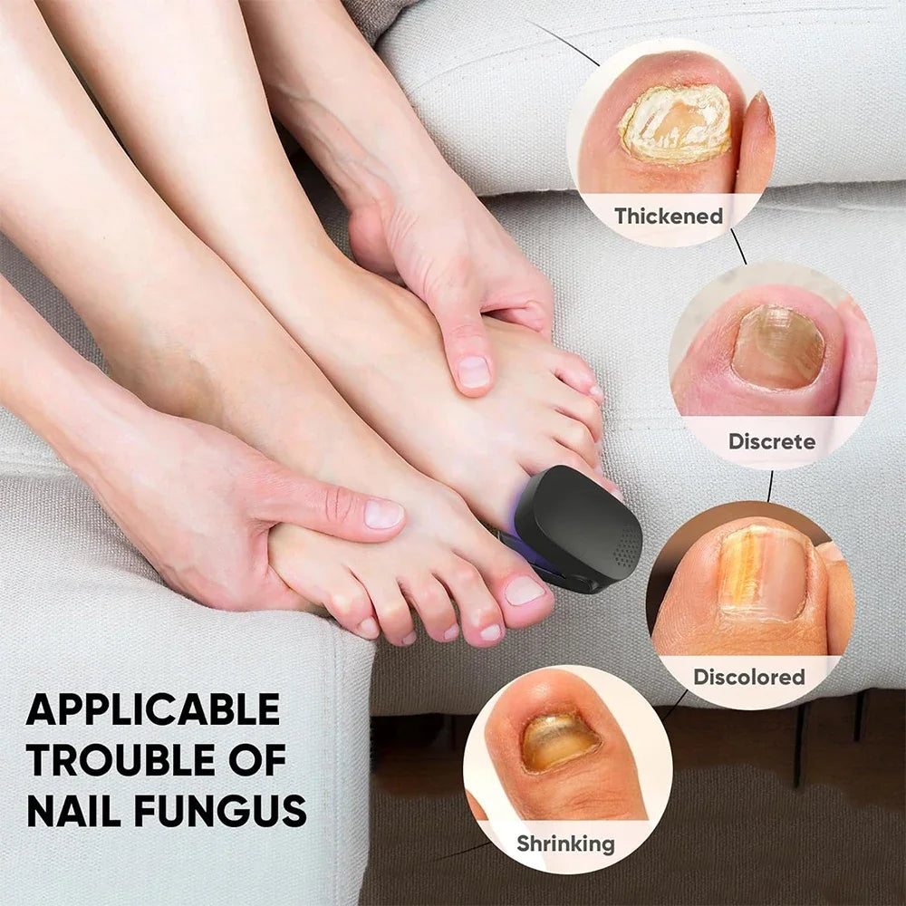 Appareil laser LED pour le traitement des mycoses des ongles, pour le nettoyage de l'onychomycose, charge USB, lumière infrarouge 905 nm, lumière bleue 470 nm, salon de manucure