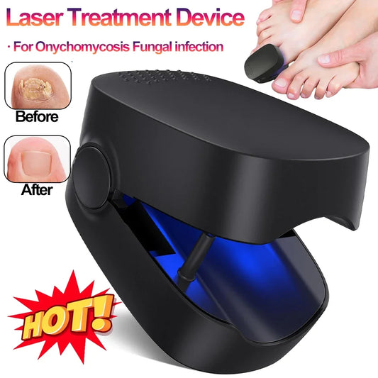 Appareil laser LED pour le traitement des mycoses des ongles, pour le nettoyage de l'onychomycose, charge USB, lumière infrarouge 905 nm, lumière bleue 470 nm, salon de manucure